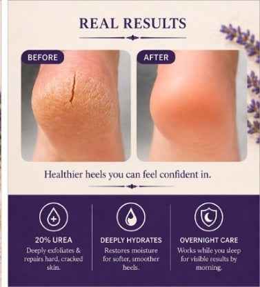 Heel Rescue MAX Treatment